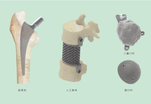 三維打印髖關(guān)節(jié)技術(shù)新動態(tài)，重塑生活的科技魔法奇跡