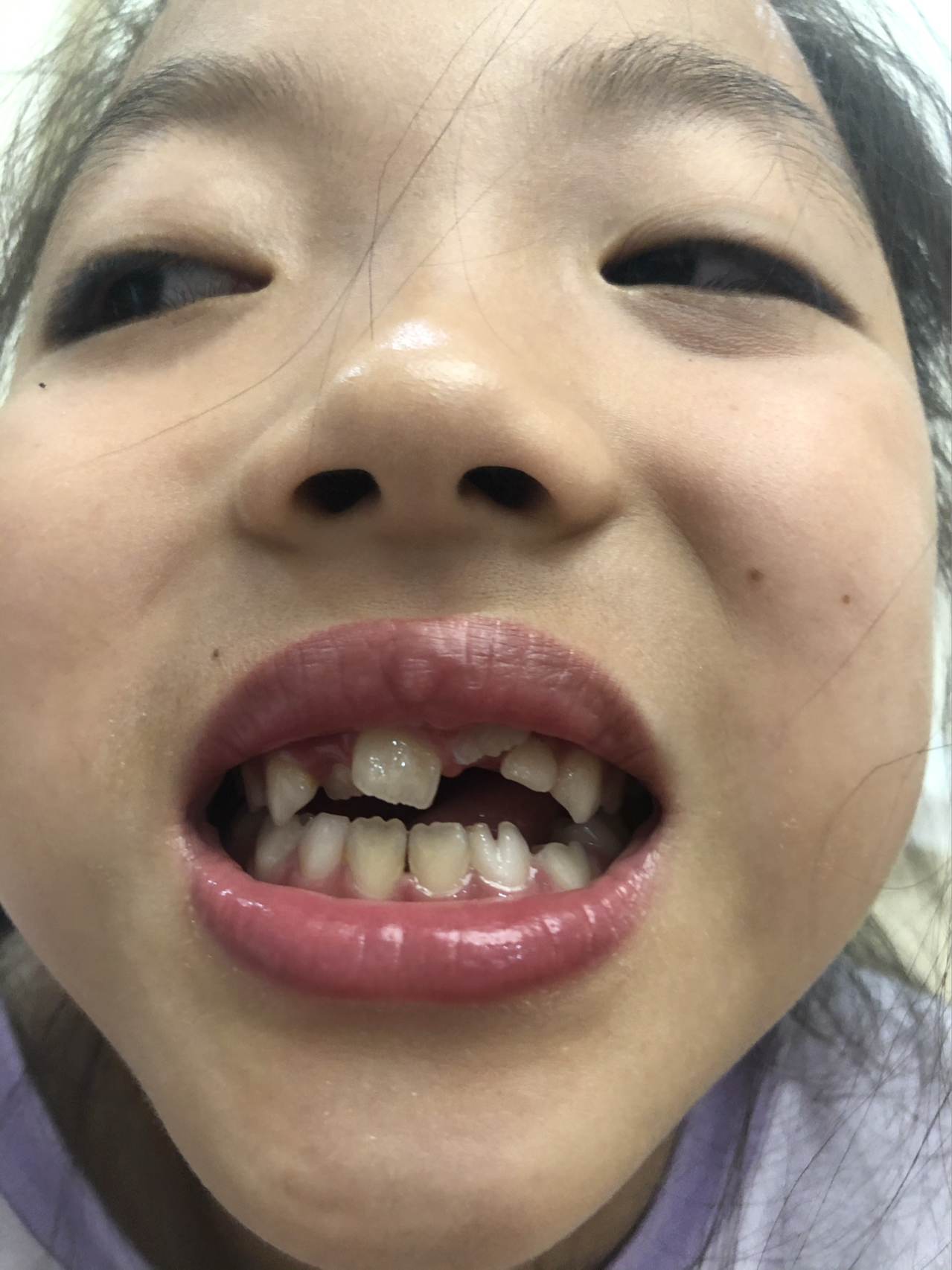 莊最新牙齒技術(shù)揭秘，牙齒美容新選擇